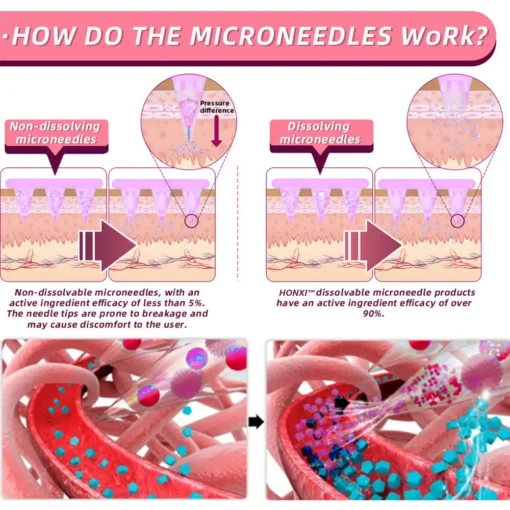 HonXi® Nano Microneedle Slimming Patch